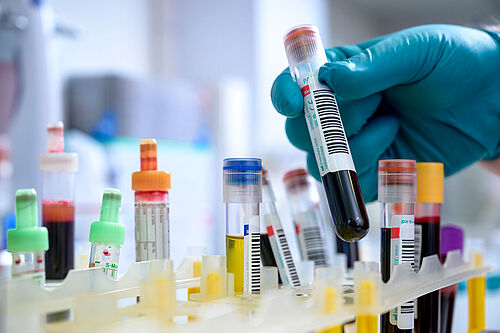 Symbolic image shows blood and urine samples.