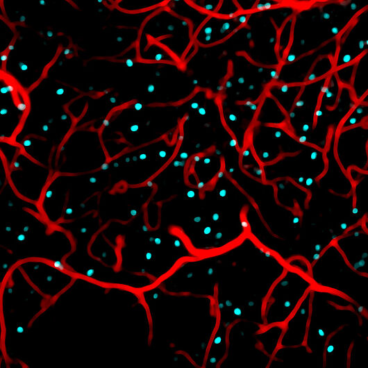 This image shows active nerve cells (cyan) and blood vessels (red) in the hippocampus of a mouse. 