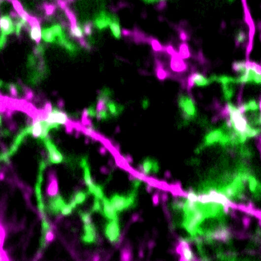 Unter dem Mikroskop: Mikroglia (grün), Nervenzellen mit Synapsen (magenta). Quelle: DZNE/Felix Nebeling