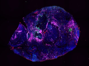 Complex tissue culture under the microscope. 