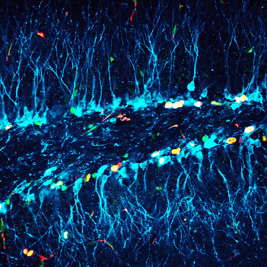 Microscope image of a newborn nerve cell.