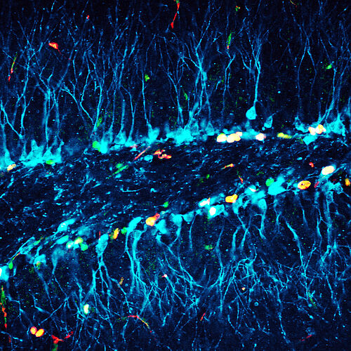Mikroskopaufnahme einer neugeborenen Nervenzelle.