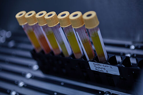 This symbolic picture shows blood samples.