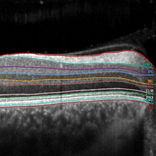 Cross-section through the human retina showing its different layers.