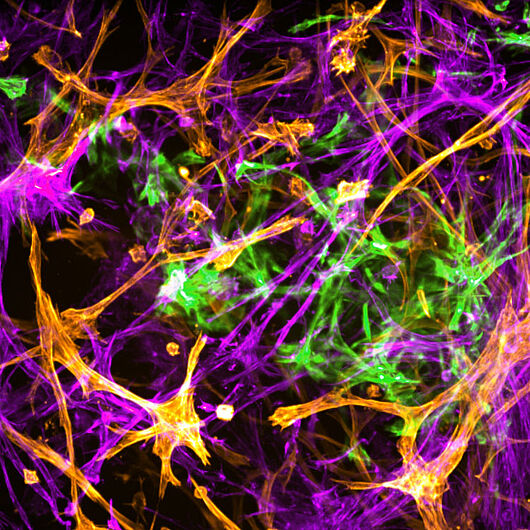 his microscopic image shows networks of neurons as they typically develop in 3D cell cultures.