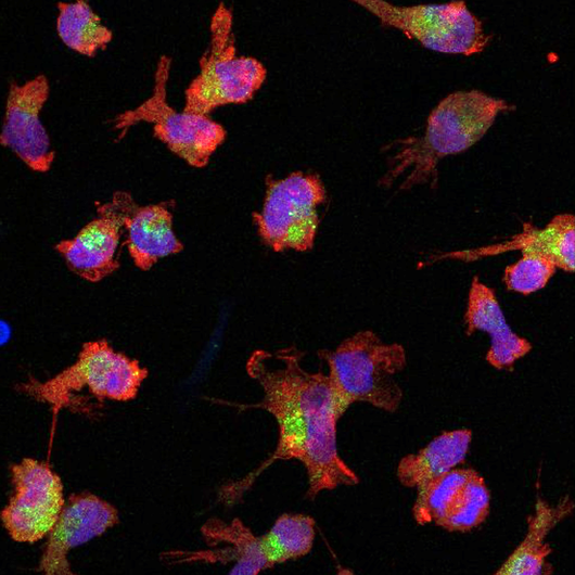 Microglia cells under the microscope. 