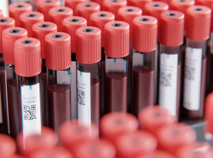 Symbolic image shows blood samples in rack.