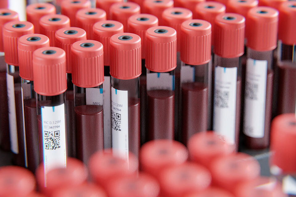 Symbolic image shows blood samples in rack.