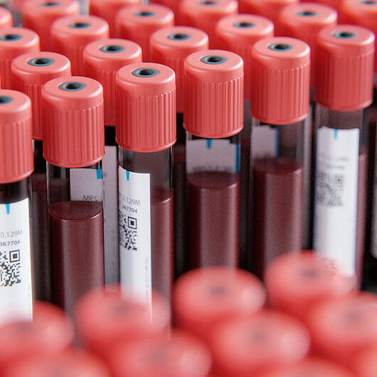 Symbolic image shows blood samples in rack.