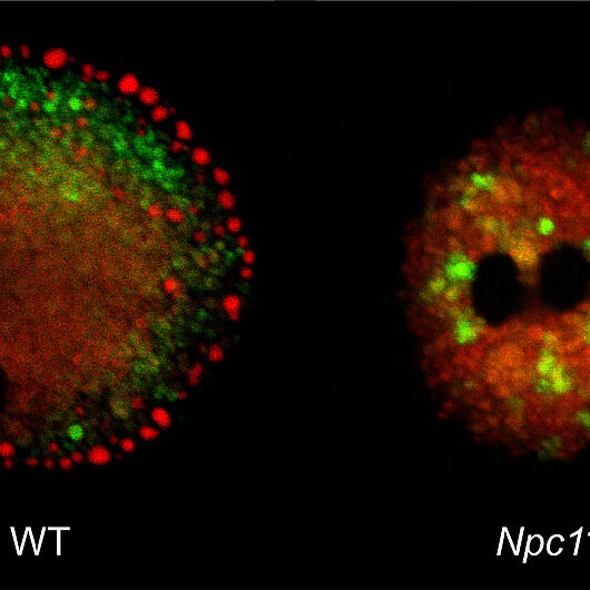 Die mikroskopische Aufnahme der Mikroglia zeigt Störungen im Umgang dieser Fresszellen, die zum Immunsystem des Gehirns gehören, mit einverleibtem Material.