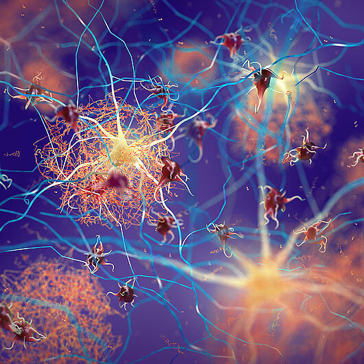 Artistic visualization of protein deposits in the vicinity of nerve cells