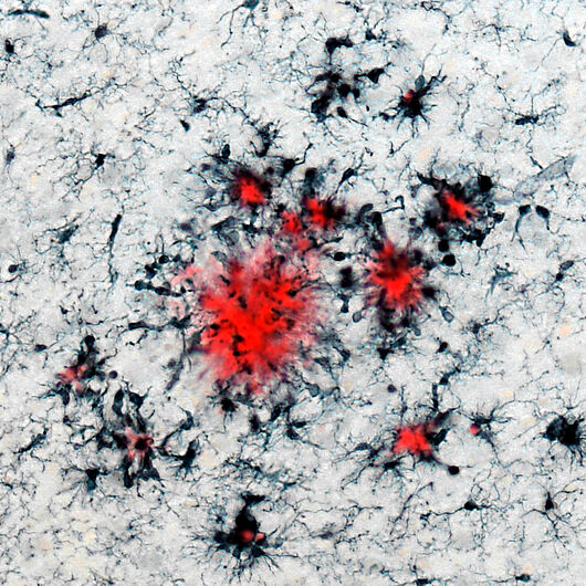 This image shows such immune cells (in black) clustered around plaques (in red), which are insoluble protein deposits characteristic of Alzheimer’s disease. 