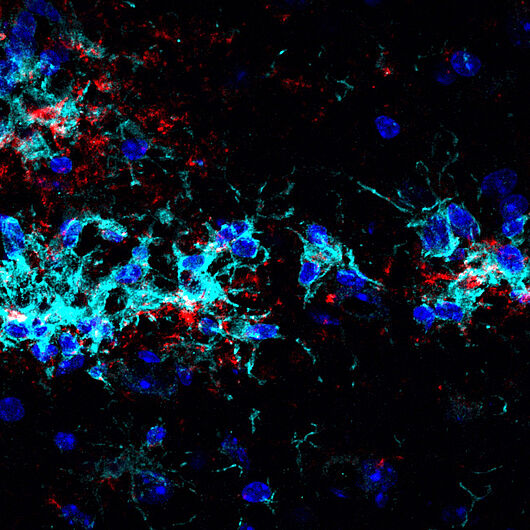 Die Abbildung zeigt auf diese Weise stimulierte Mikroglia (cyan), die sich um Ablagerungen von Proteinen – sogenannte Plaques (rot) - sammeln und diese abbauen.