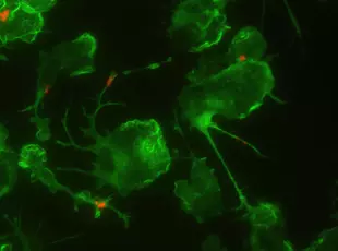 Das Mikroskopiebild zeigt Mikroglia (grün), die Amyloid-beta (rot) phagozytieren.