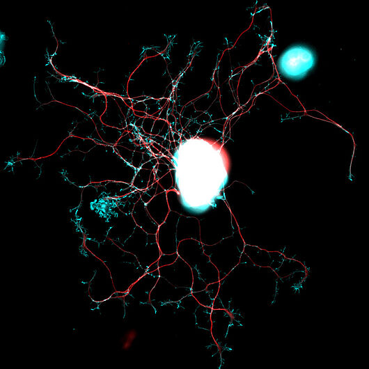 Dorsal root ganglia neuron under the microscope